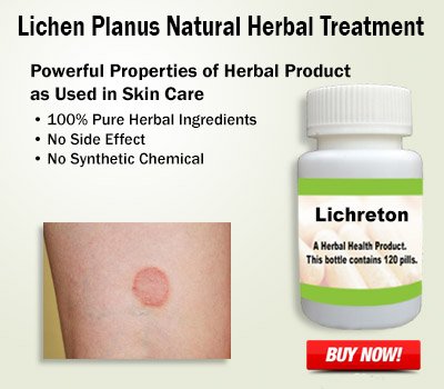 You are currently viewing Finding Relief from Lichen Planus with Natural Supplements