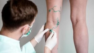 Read more about the article What Kind Of Doctor Treats Veins? What Is A Varicose Vein Specialist Called?
